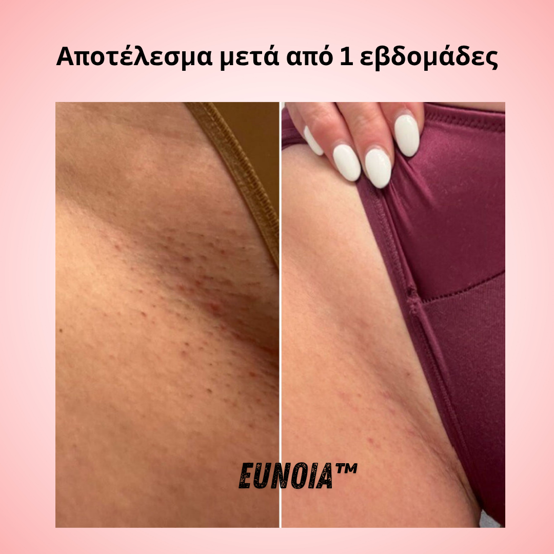 Helaion™  Απαλή περιποίηση ευαίσθητης περιοχής