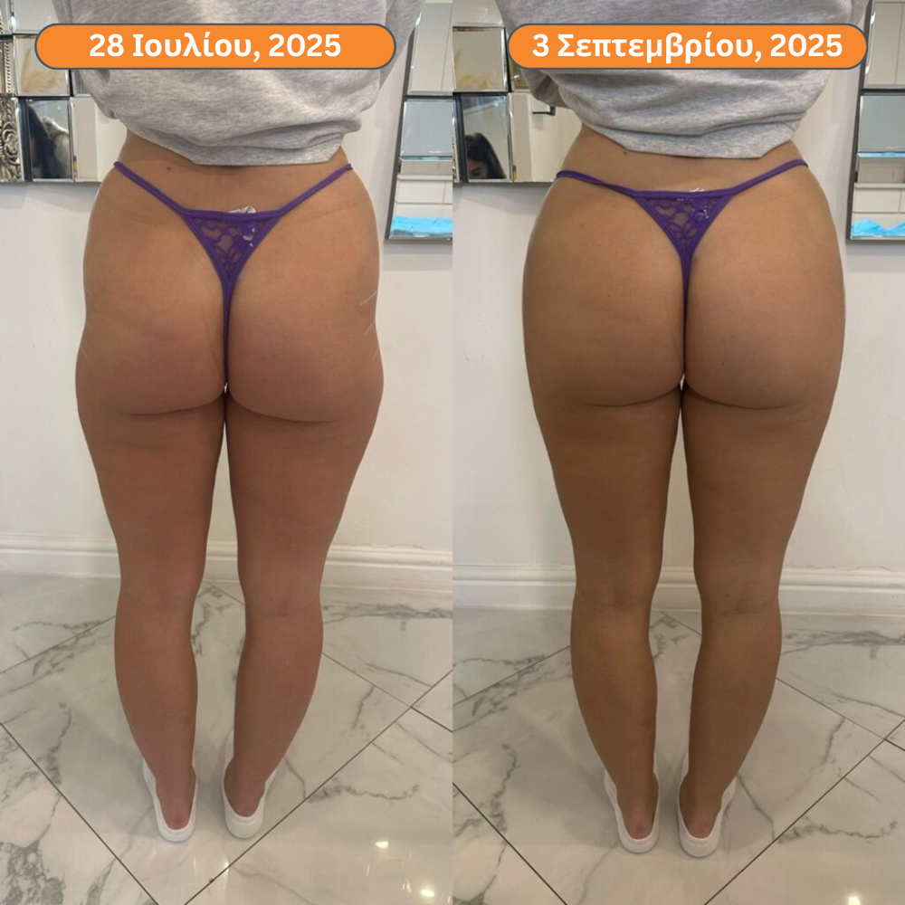 <p><strong>Αγαπημένο από όλους, παντού. Μην το χάσεις.</strong></p>