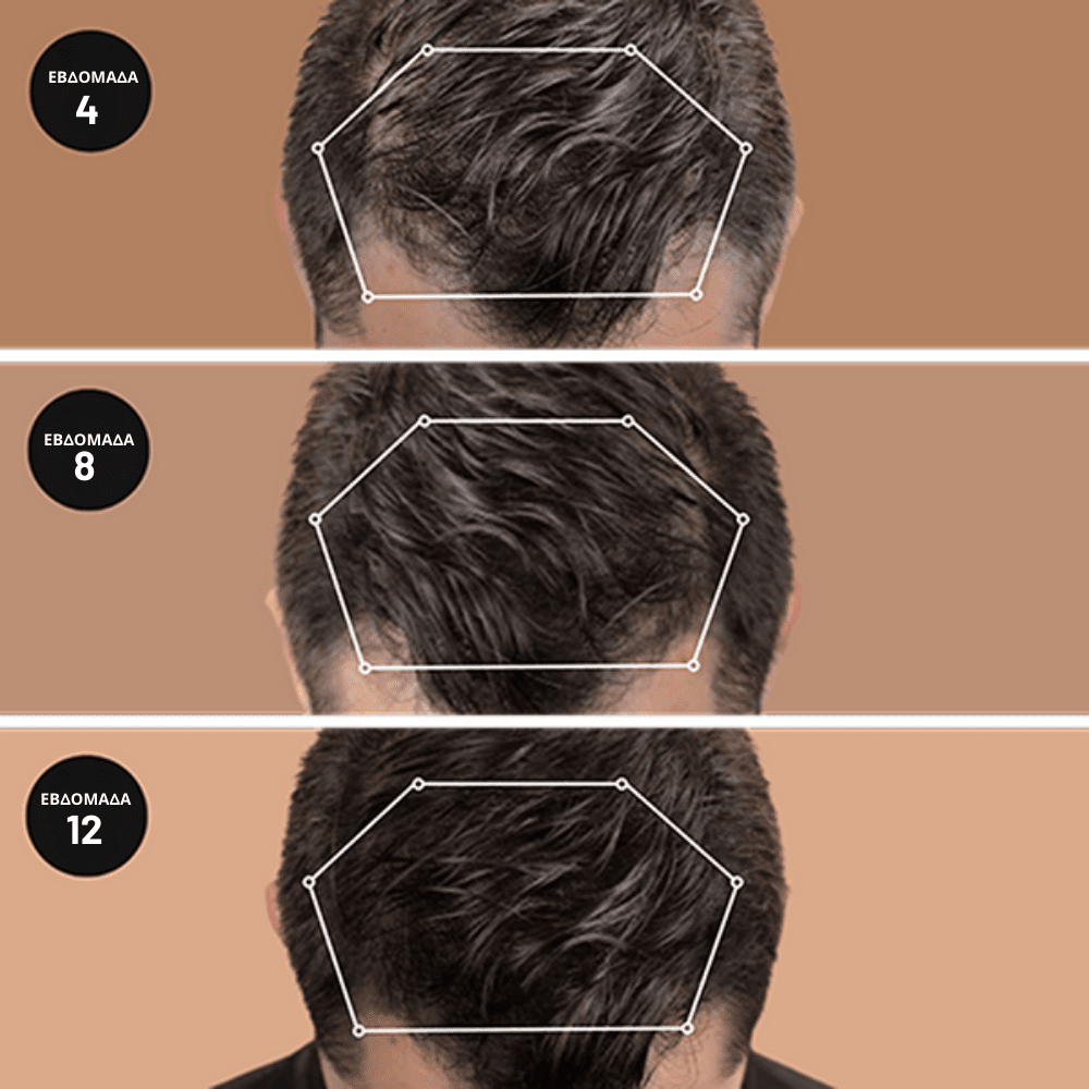 Σαμπουάν Ενδυνάμωσης Ρίζας [Activator Shampoo]