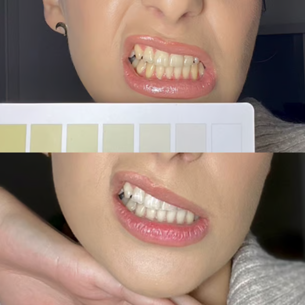 <p><strong>Αγαπημένο από όλους, παντού. Μην το χάσεις.</strong></p>