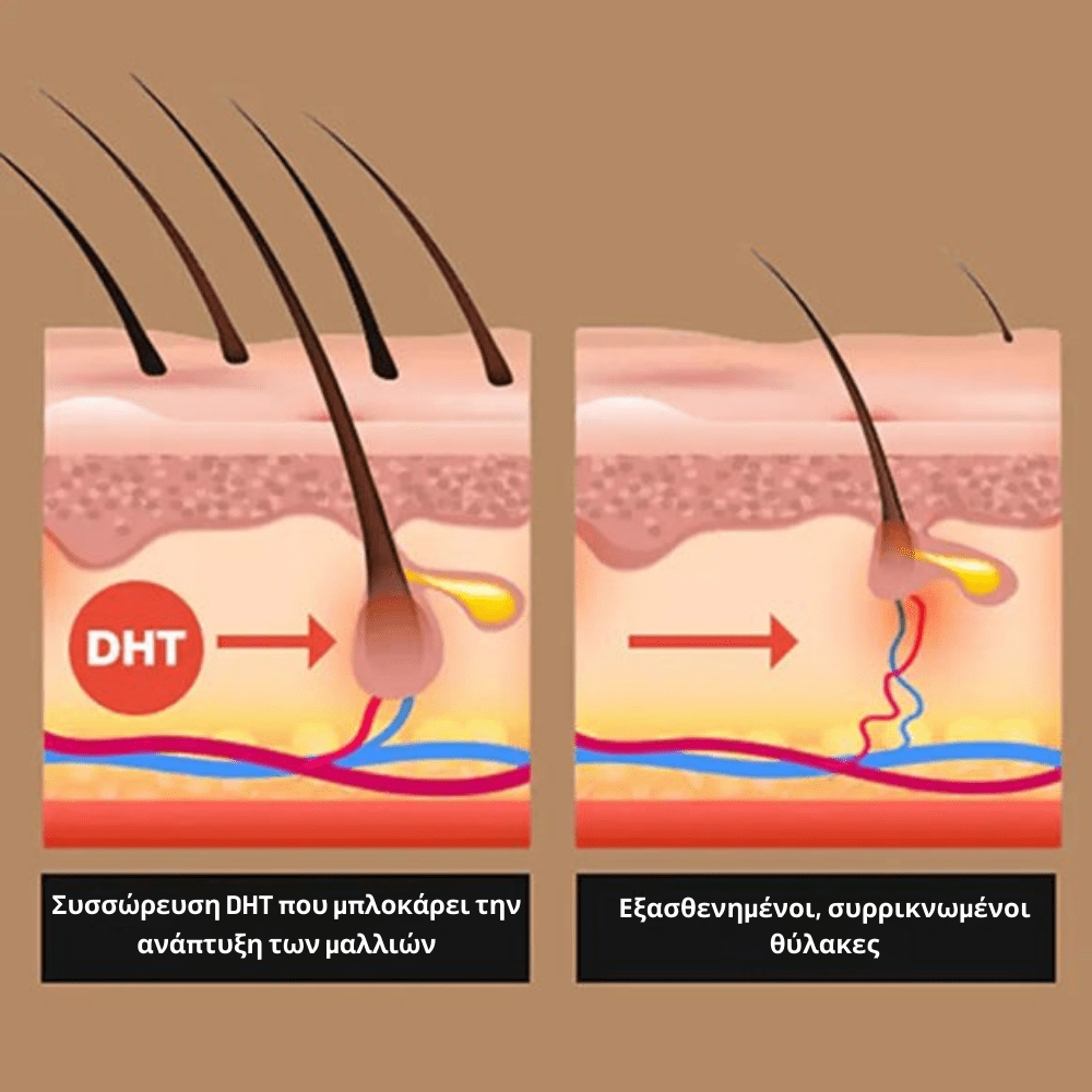 Σαμπουάν Ενδυνάμωσης Ρίζας [Activator Shampoo]