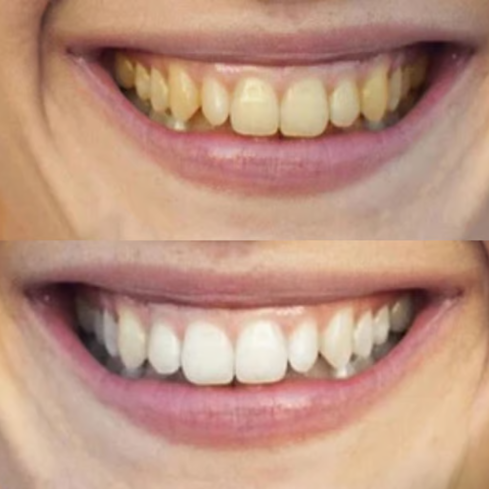 <p><strong>Αγαπημένο από όλους, παντού. Μην το χάσεις.</strong></p>