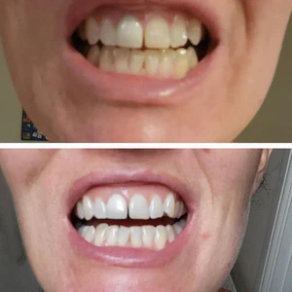 <p><strong>Αγαπημένο από όλους, παντού. Μην το χάσεις.</strong></p>