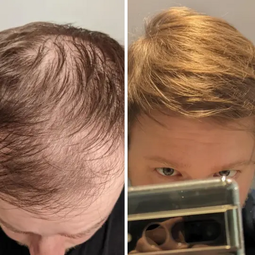 <p><strong>Αγαπημένο από όλους, παντού. Μην το χάσεις.</strong></p>