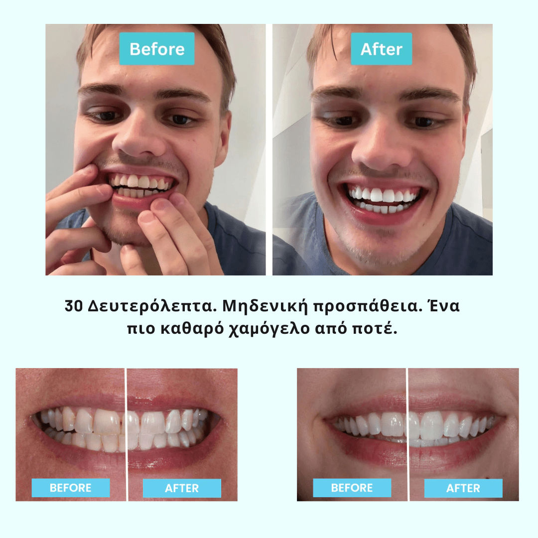 Ηλεκτρική Οδοντόβουρτσα U [Electric Toothbrush]