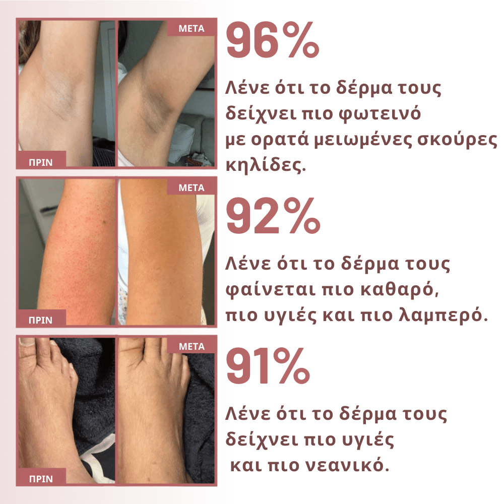 Απολεπιστικό Spray με Kojic Acid [Exfoliating Spray]