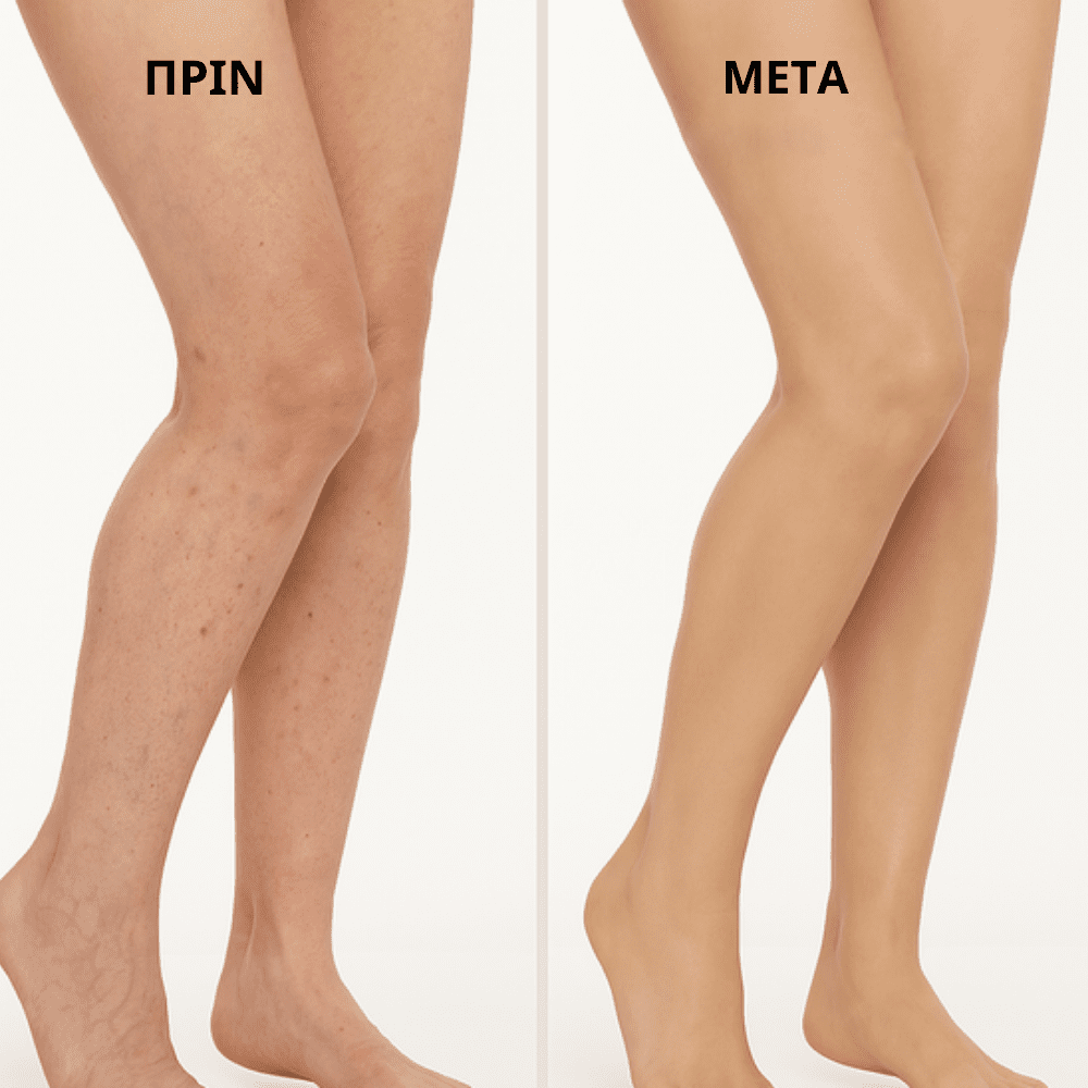 Λείο Φινίρισμα Ποδιών [Tanning Cream]