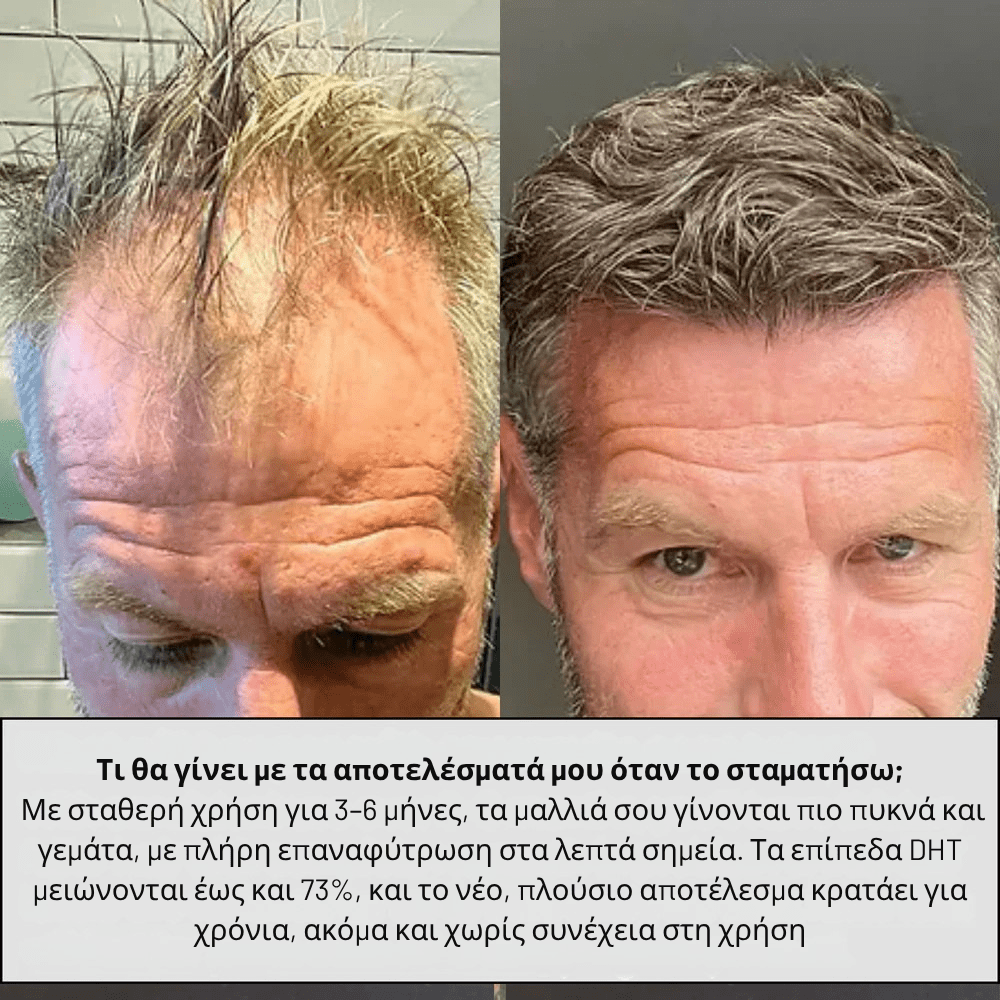Αμπούλες Ενίσχυσης Μαλλιών [Hair Boost]