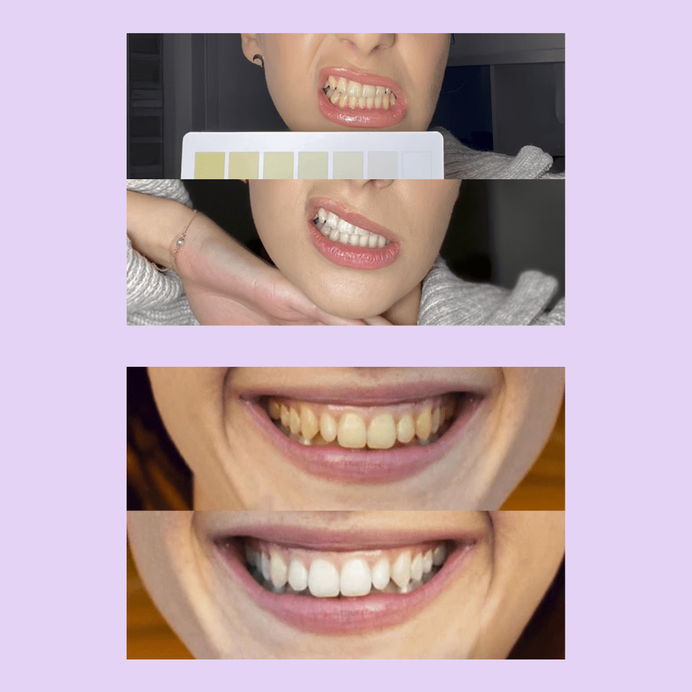 ΔΩΡΟ : 🎁 purple strips