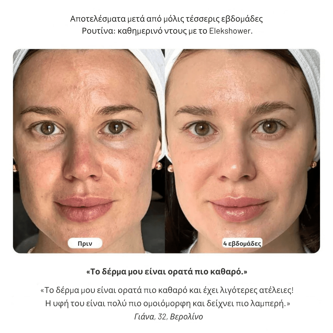 Κεφαλή Ντους & Φίλτρο [Shower Head + Filter]