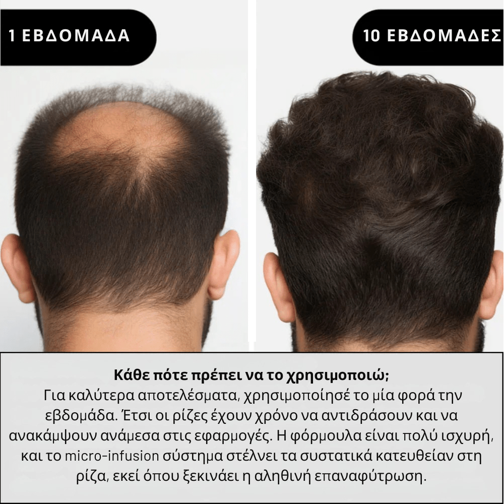 Αμπούλες Ενίσχυσης Μαλλιών [Hair Boost]