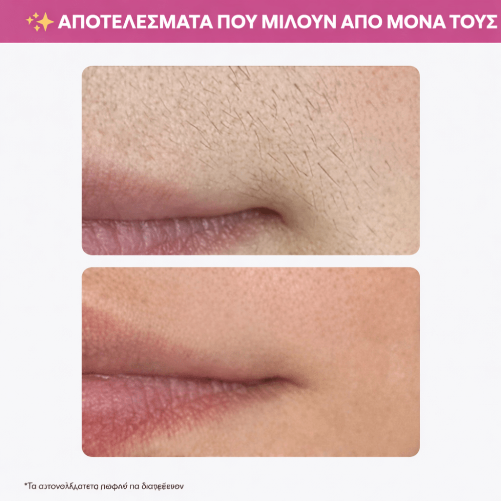 Έλαιο Λείας Επιδερμίδας Cyperus [Clear Skin Serum]