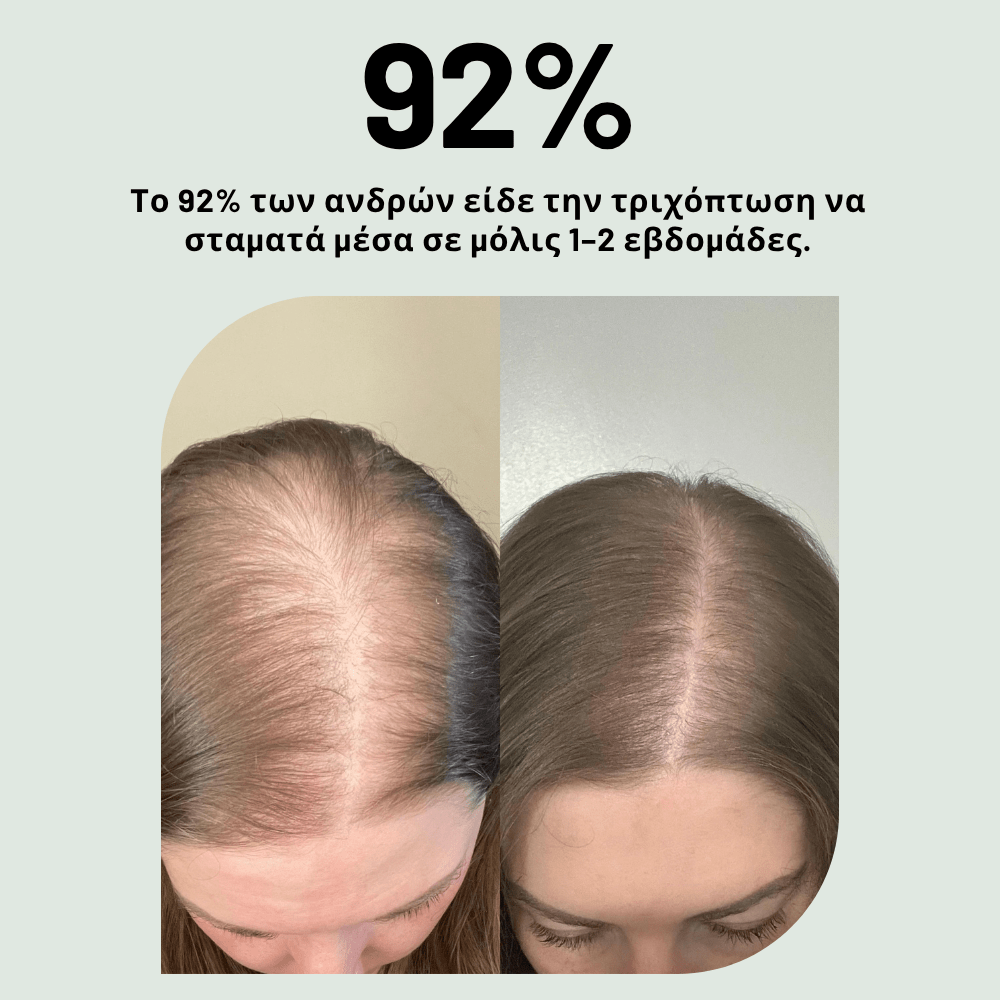 Ενίσχυσης & Επαναφύτρωσης [Hair Reactivation]