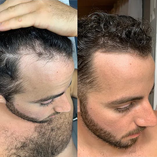 <p><strong>Αγαπημένο από όλους, παντού. Μην το χάσεις.</strong></p>