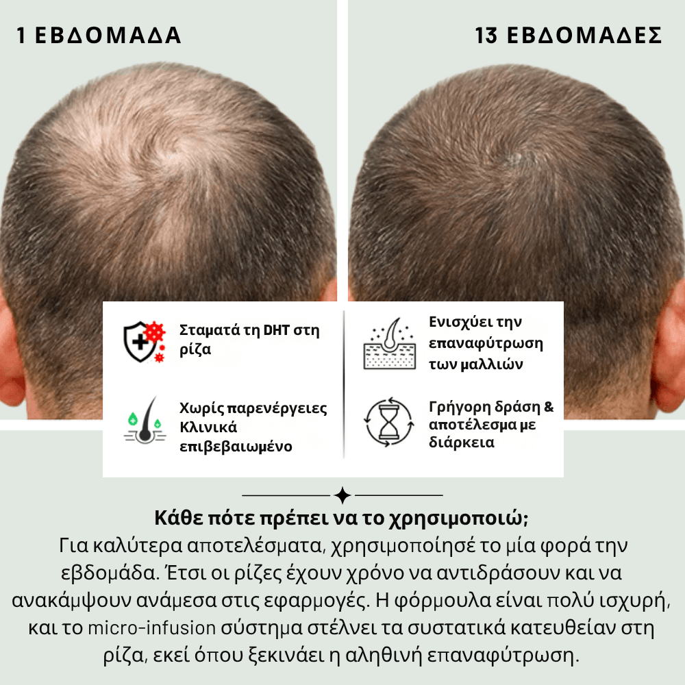 Ενίσχυσης & Επαναφύτρωσης [Hair Reactivation]