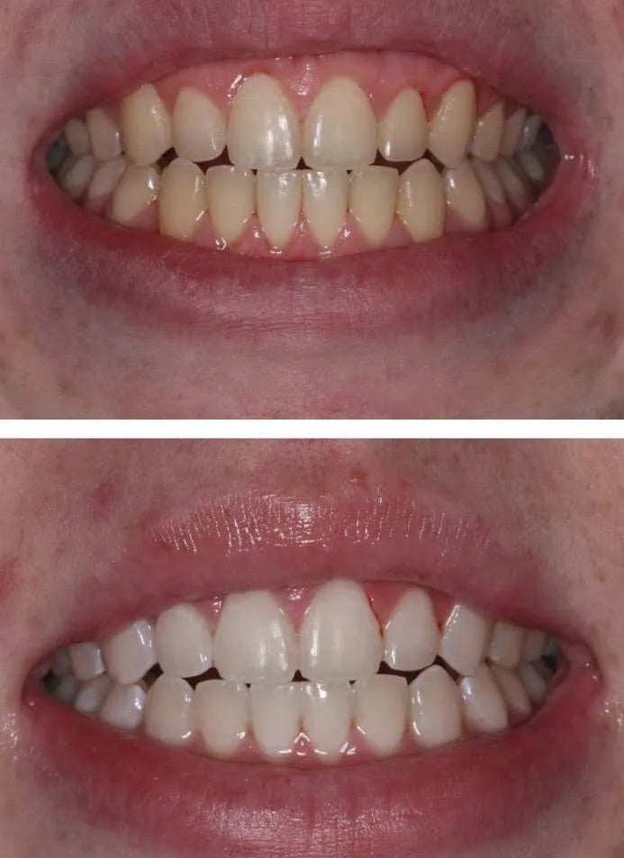 <p><strong>Αγαπημένο από όλους, παντού. Μην το χάσεις.</strong></p>