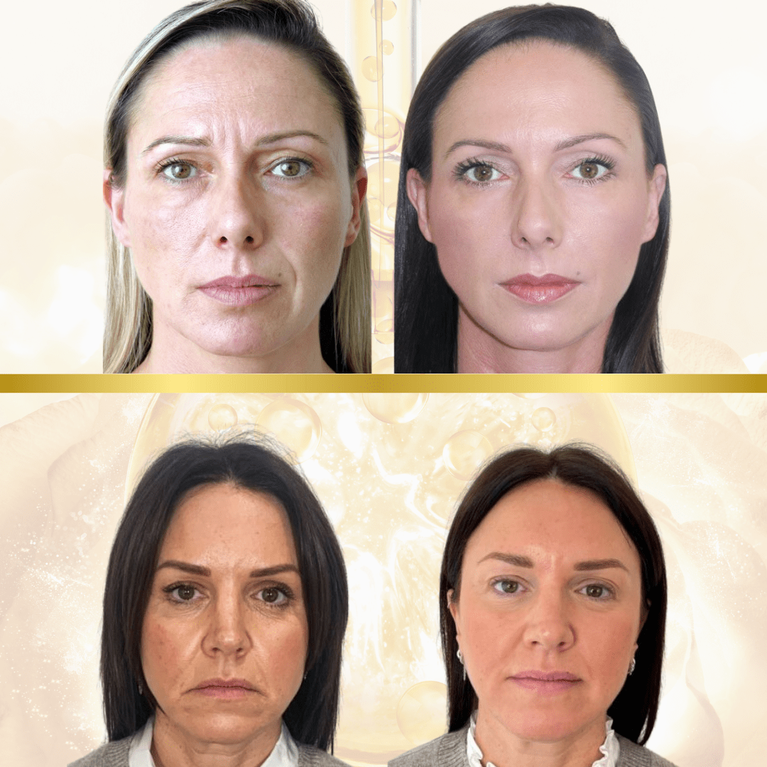 Χρυσός Ορός 24K [Gold Serum]