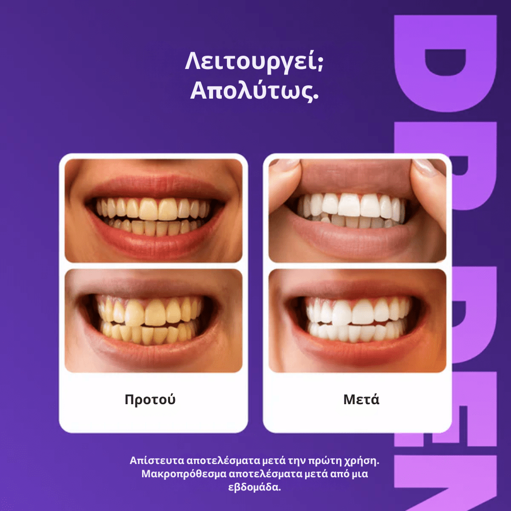 ΔΩΡΟ : 🎁 purple strips