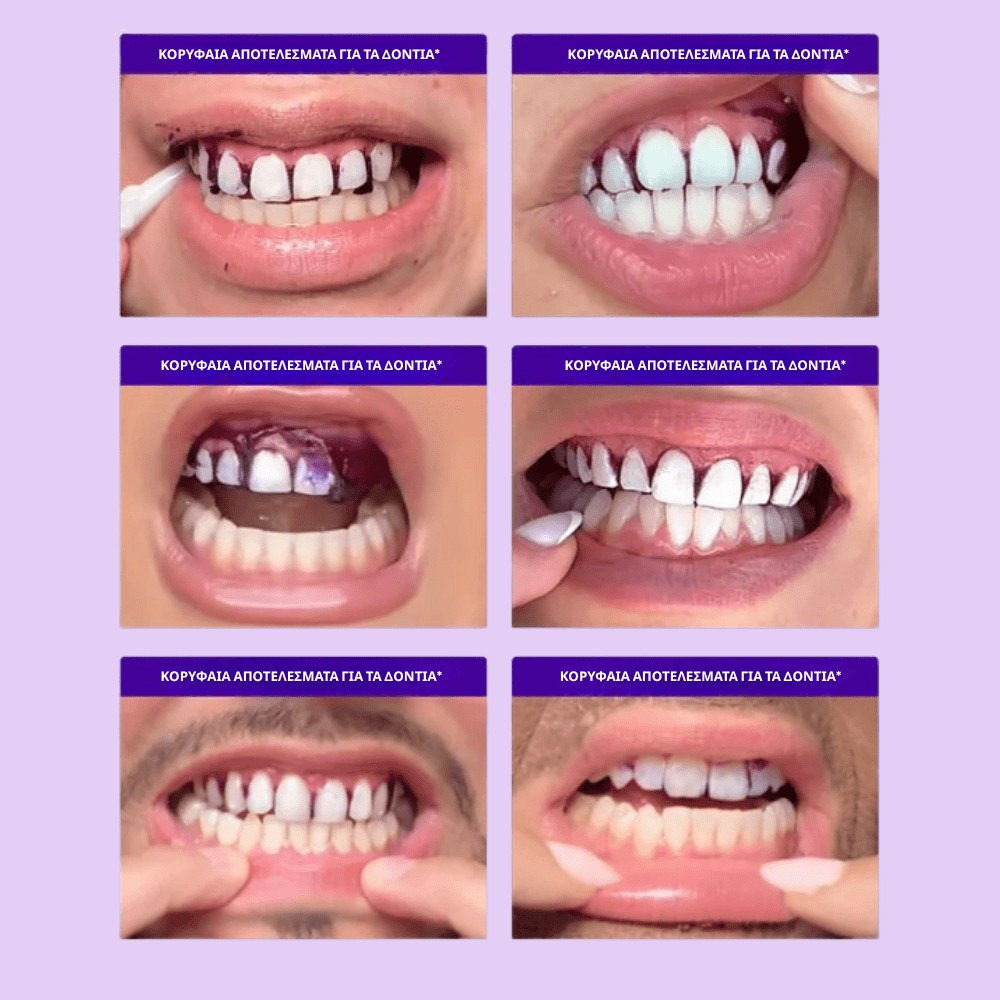 ΔΩΡΟ : 🎁 purple strips