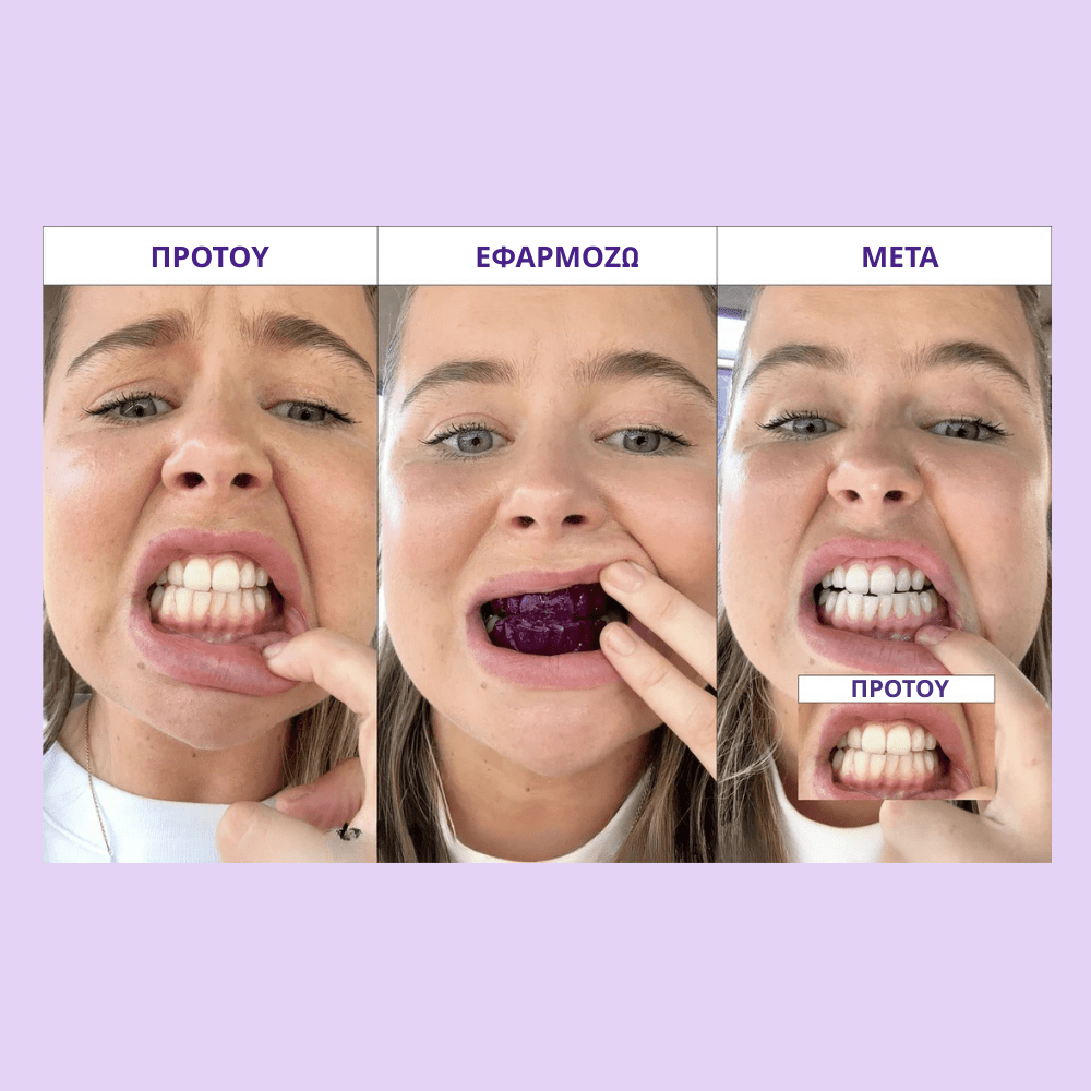 ΔΩΡΟ : 🎁 purple strips