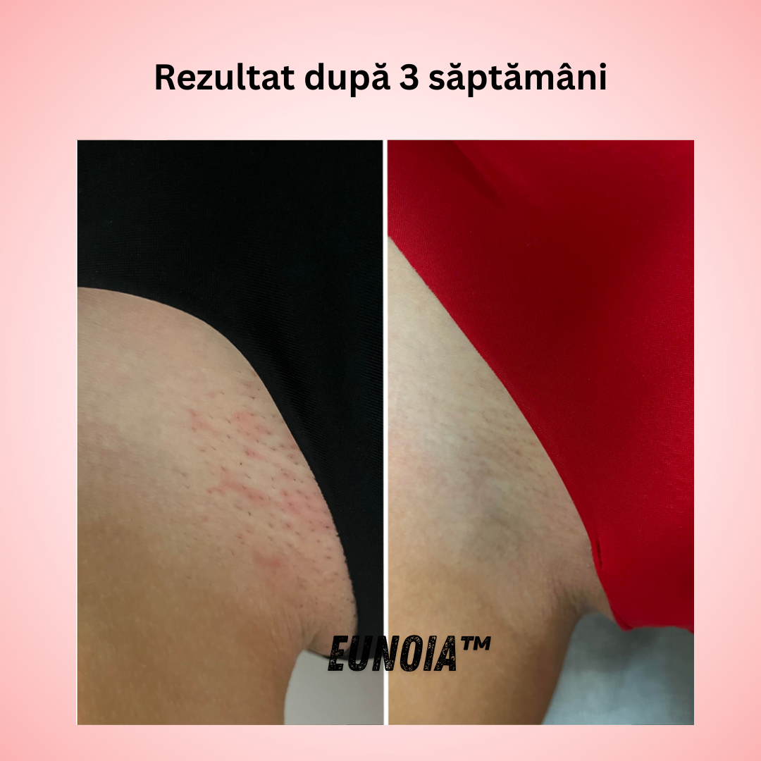 Eunoia™ Îngrijire delicată pentru zona sensibilă