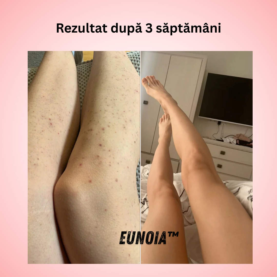 Eunoia™ Îngrijire delicată pentru zona sensibilă