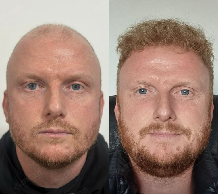 <p><strong>Αγαπημένο από όλους, παντού. Μην το χάσεις.</strong></p>