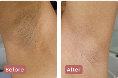 <p><strong>Αγαπημένο από όλους, παντού. Μην το χάσεις.</strong></p>