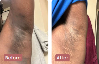 <p><strong>Αγαπημένο από όλους, παντού. Μην το χάσεις.</strong></p>