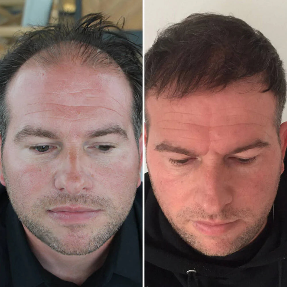 <p><strong>Αγαπημένο από όλους, παντού. Μην το χάσεις.</strong></p>