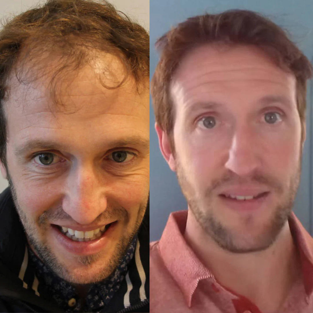 <p><strong>Αγαπημένο από όλους, παντού. Μην το χάσεις.</strong></p>