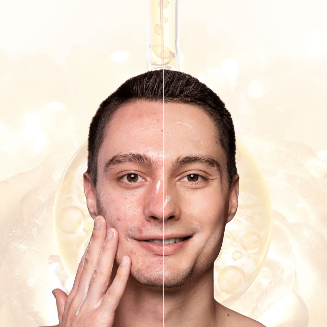 Χρυσός Ορός 24K [Gold Serum]