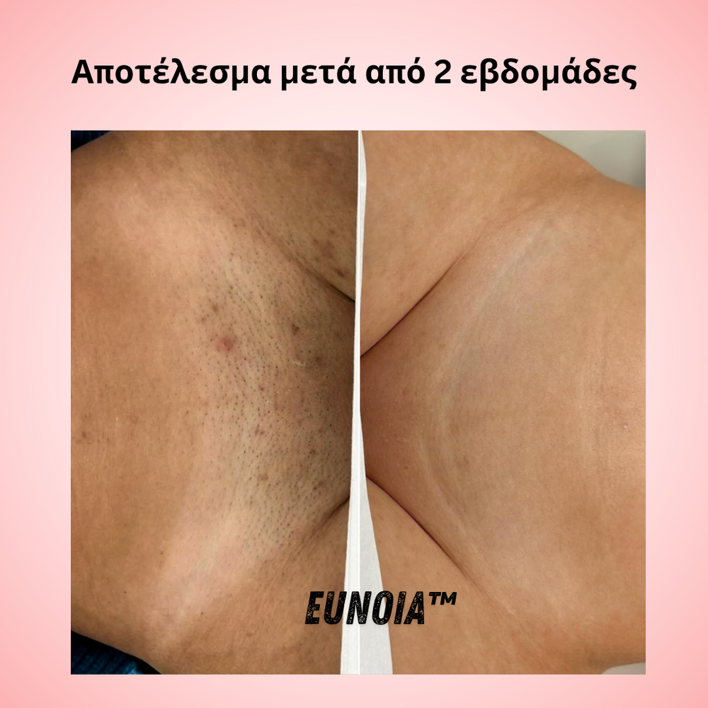 <p><strong>Αγαπημένο από όλους, παντού. Μην το χάσεις.</strong></p>