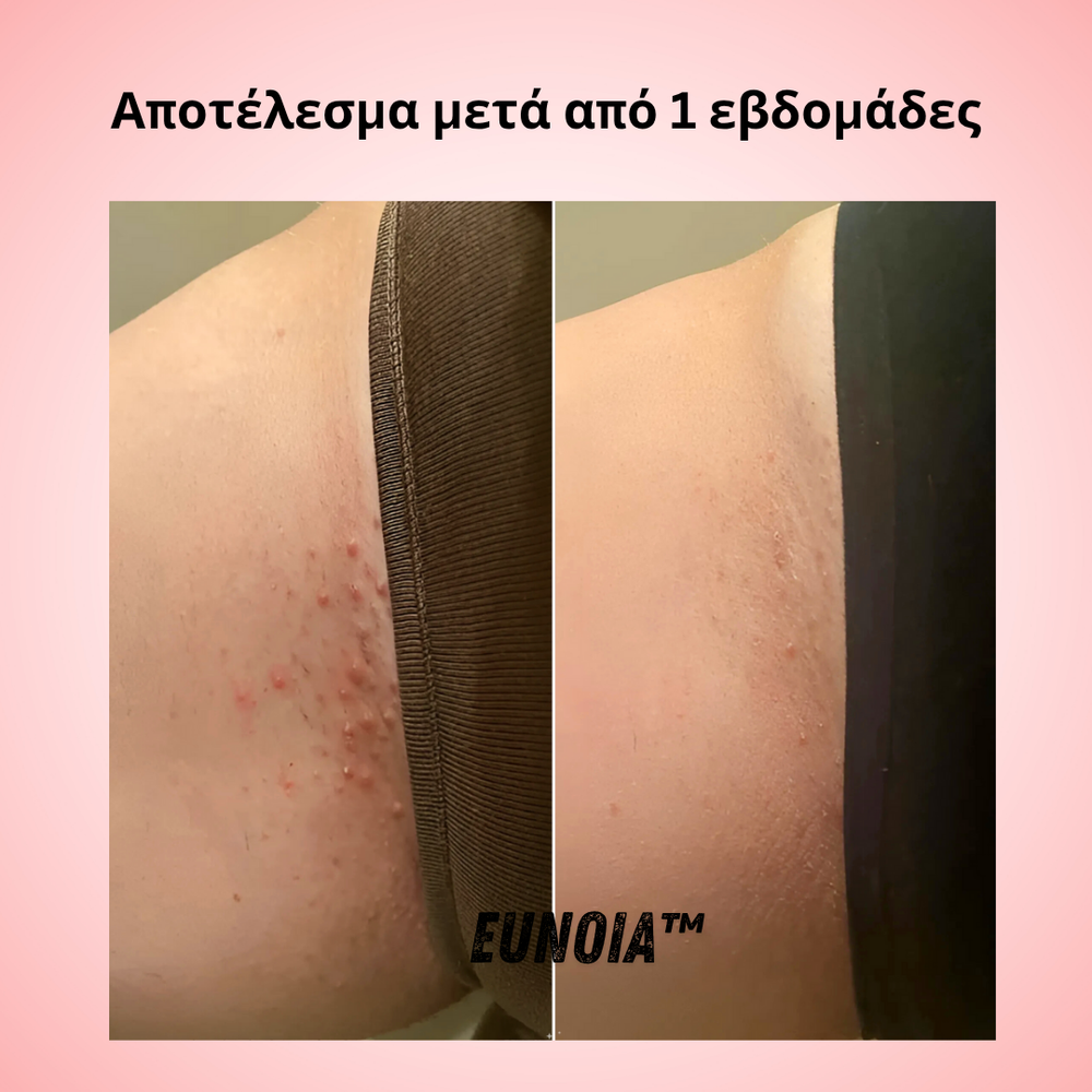 <p><strong>Αγαπημένο από όλους, παντού. Μην το χάσεις.</strong></p>