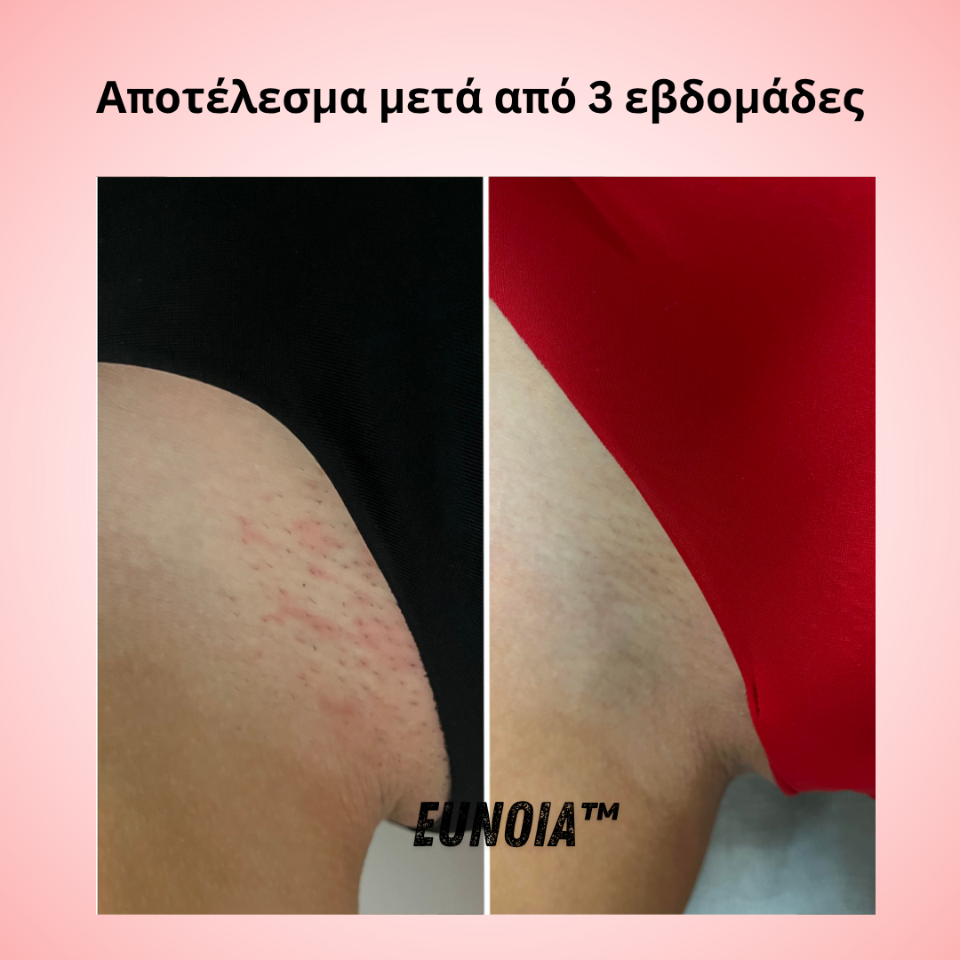 Helaion™  Απαλή περιποίηση ευαίσθητης περιοχής