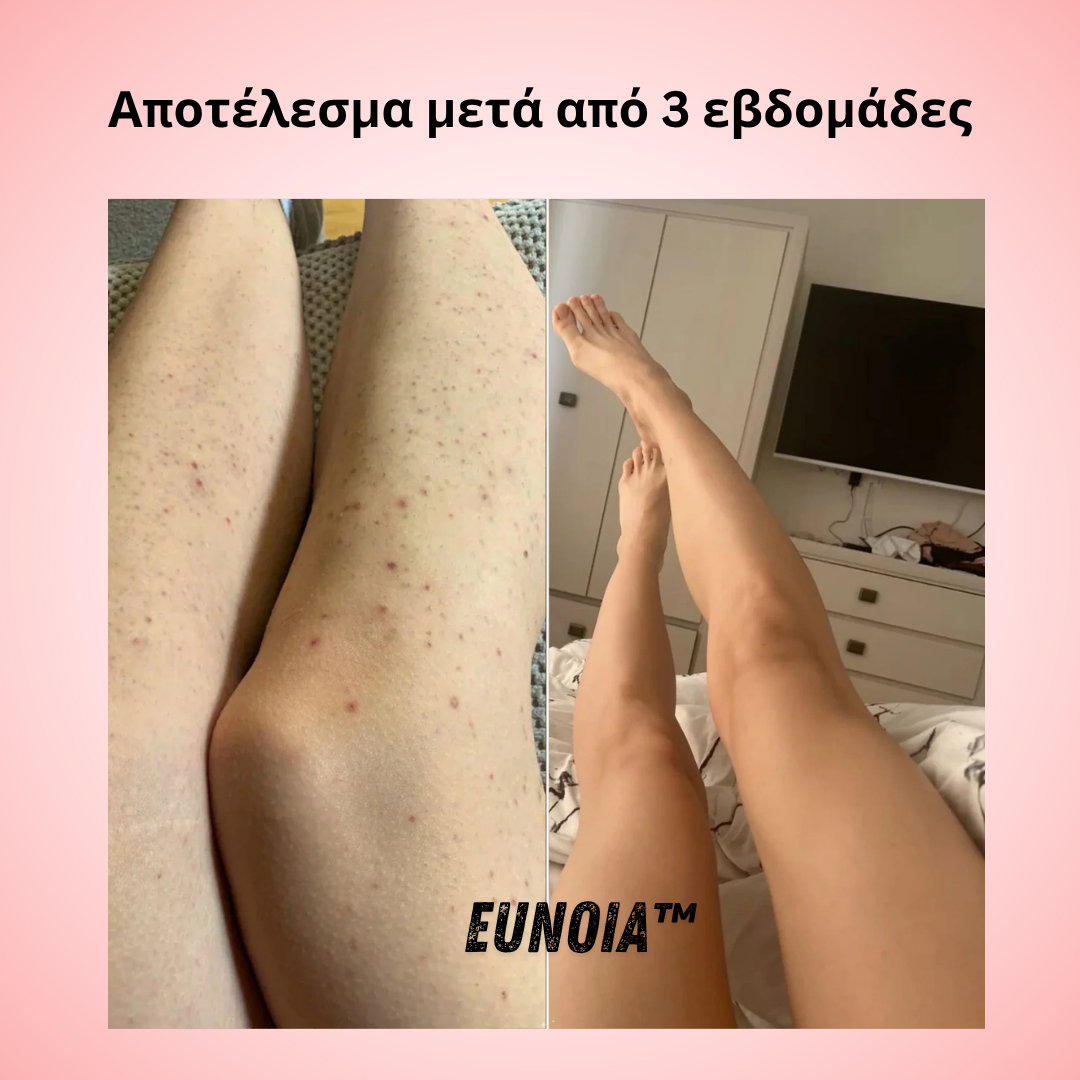 Helaion™  Απαλή περιποίηση ευαίσθητης περιοχής
