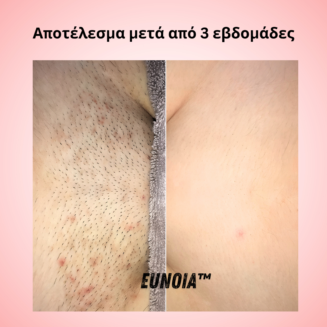 Helaion™  Απαλή περιποίηση ευαίσθητης περιοχής