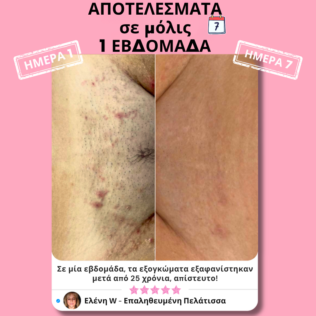 Helaion™  Απαλή περιποίηση ευαίσθητης περιοχής
