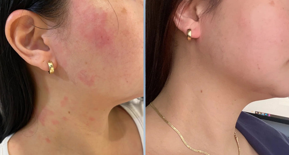 <p><strong>Αγαπημένο από όλους, παντού. Μην το χάσεις.</strong></p>