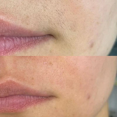 <p><strong>Αγαπημένο από όλους, παντού. Μην το χάσεις.</strong></p>