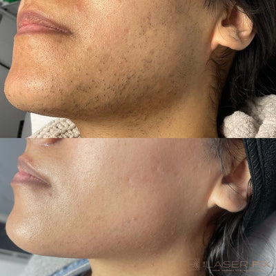 <p><strong>Αγαπημένο από όλους, παντού. Μην το χάσεις.</strong></p>