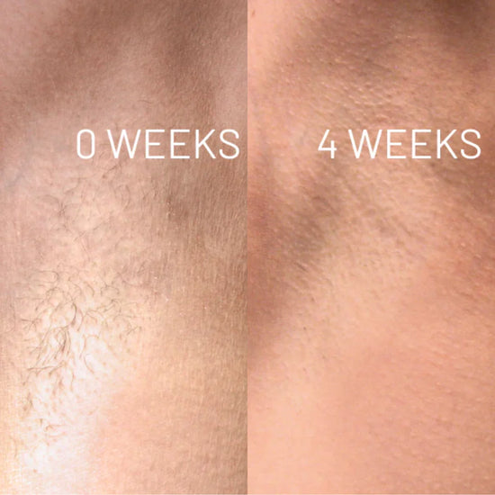 <p><strong>Αγαπημένο από όλους, παντού. Μην το χάσεις.</strong></p>