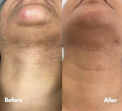 <p><strong>Αγαπημένο από όλους, παντού. Μην το χάσεις.</strong></p>