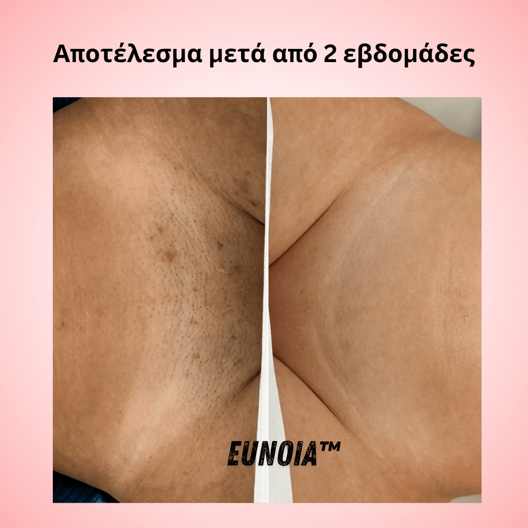 Helaion™  Απαλή περιποίηση ευαίσθητης περιοχής