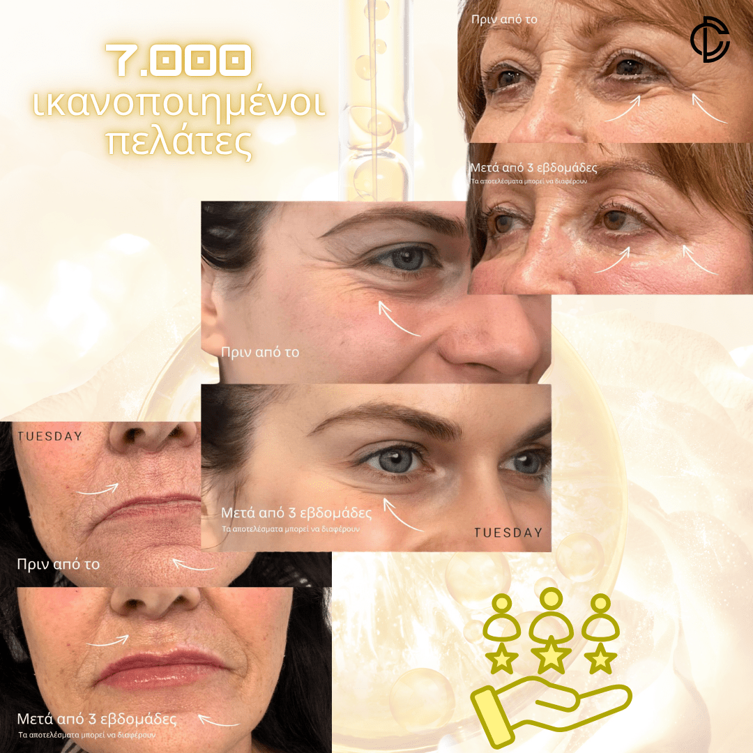 Χρυσός Ορός 24K [Gold Serum]
